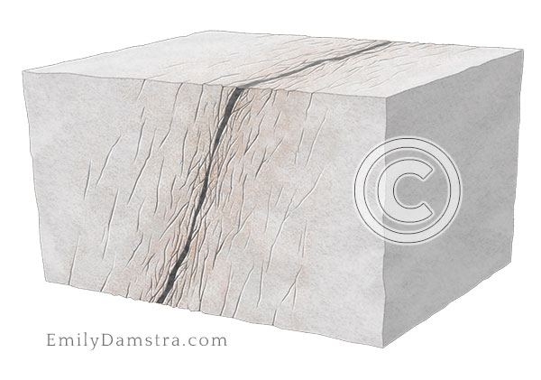 fracture zones Damstra